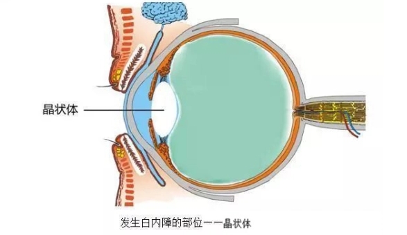 这个眼疾，到了一定年龄，几乎人人都有。